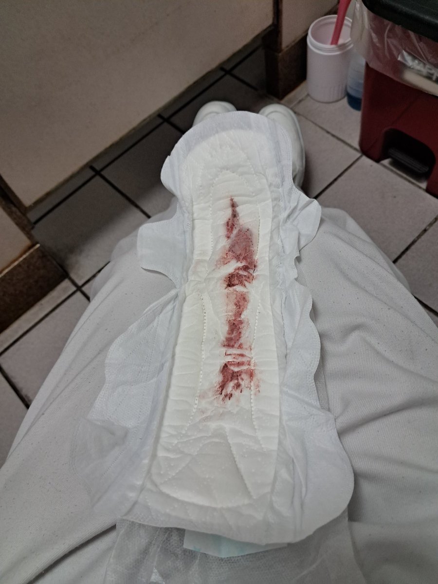 wangp2928's tweet photo. 病房巡房一整天，白袍下的濕熱早就超標。
厚實的衛生棉吸滿了滾燙，連外層的蕾絲內褲都沾染了那股揮之不去的暖香。
​這一組剛褪下的「全套紀錄」，
帶著最真實的體溫��沈甸甸的重量。
誰想私藏這份從病房帶出來、最濃郁的私密精華？🌿
​📩 私訊領取今日份的「成套誘惑」。
#護理師 #原味 #衛生棉 #私藏 https://t.co/vhIEb6DvOm