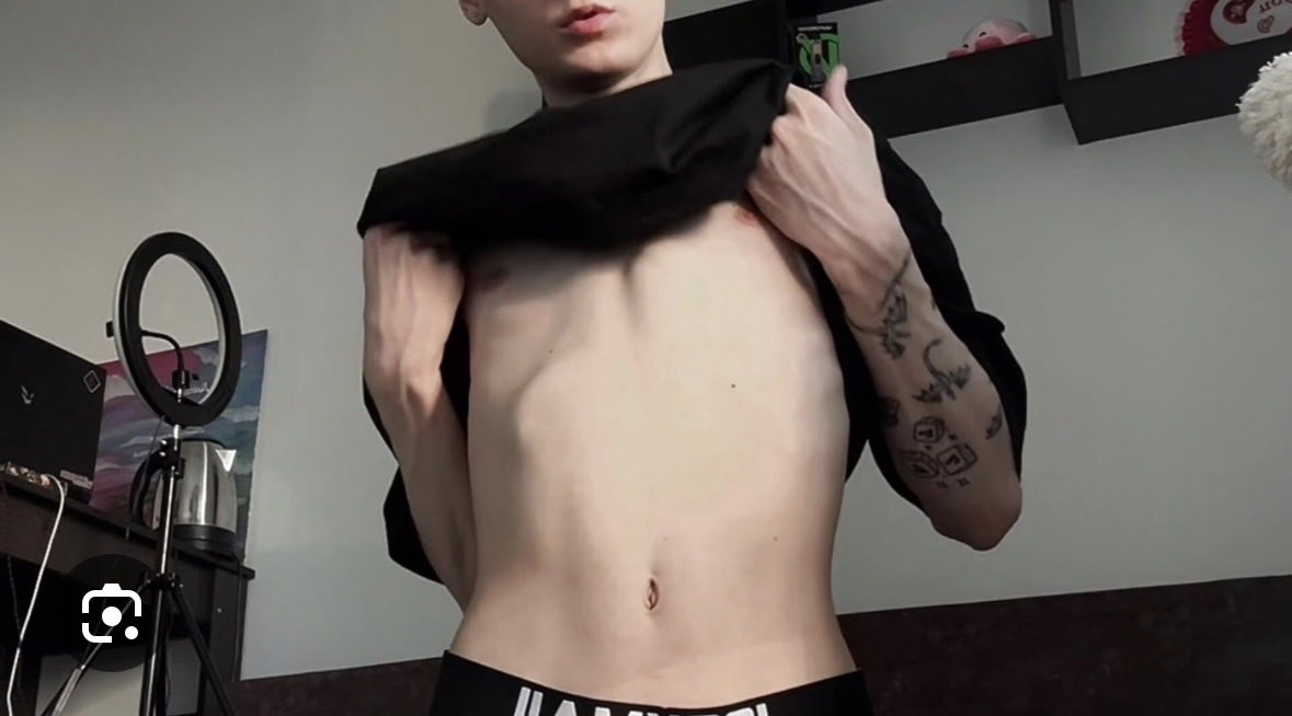 cherlybay's tweet photo. my boobs befor and after hormones 🥹🏳️‍⚧️ https://t.co/qY1WXbVUYY