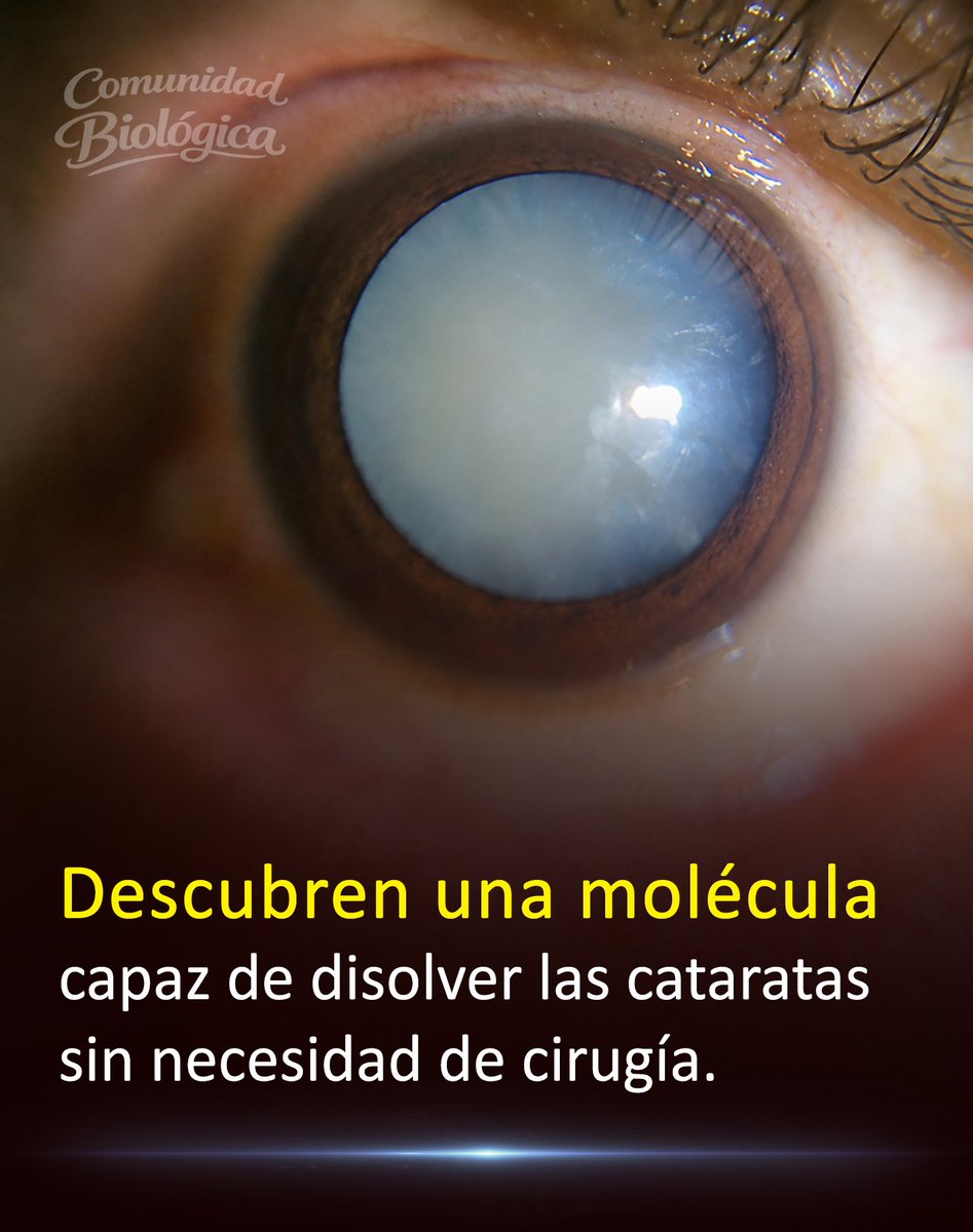 Las cataratas son la principal causa de ceguera en el mundo y afectan a decenas de millones de personas.

Actualmente, la única solución médica establecida para recuperar la visión implica someterse a una intervención quirúrgica.

Sin embargo, investigadores encontraron una