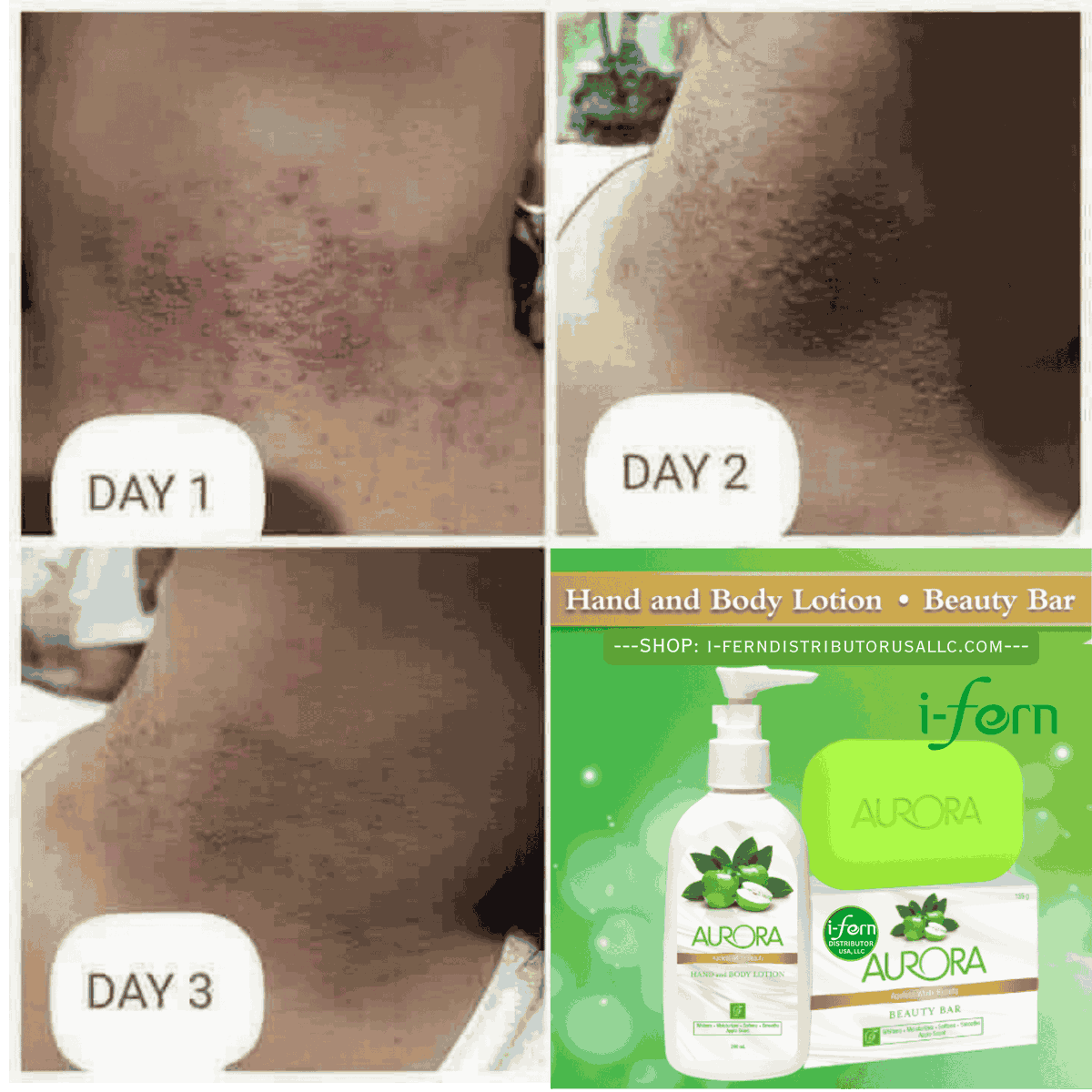 ifern_llc2024's tweet image. Transform your skin with Aurora Hand &amp;amp; Body Whitening Lotion. Triple moisturizing &amp;amp; age-defying for just $16.99. Embrace your glow today! #SkincareRoutine #BeautyEssentials

Shop Now i-ferndistributorusallc.com/products/auror…