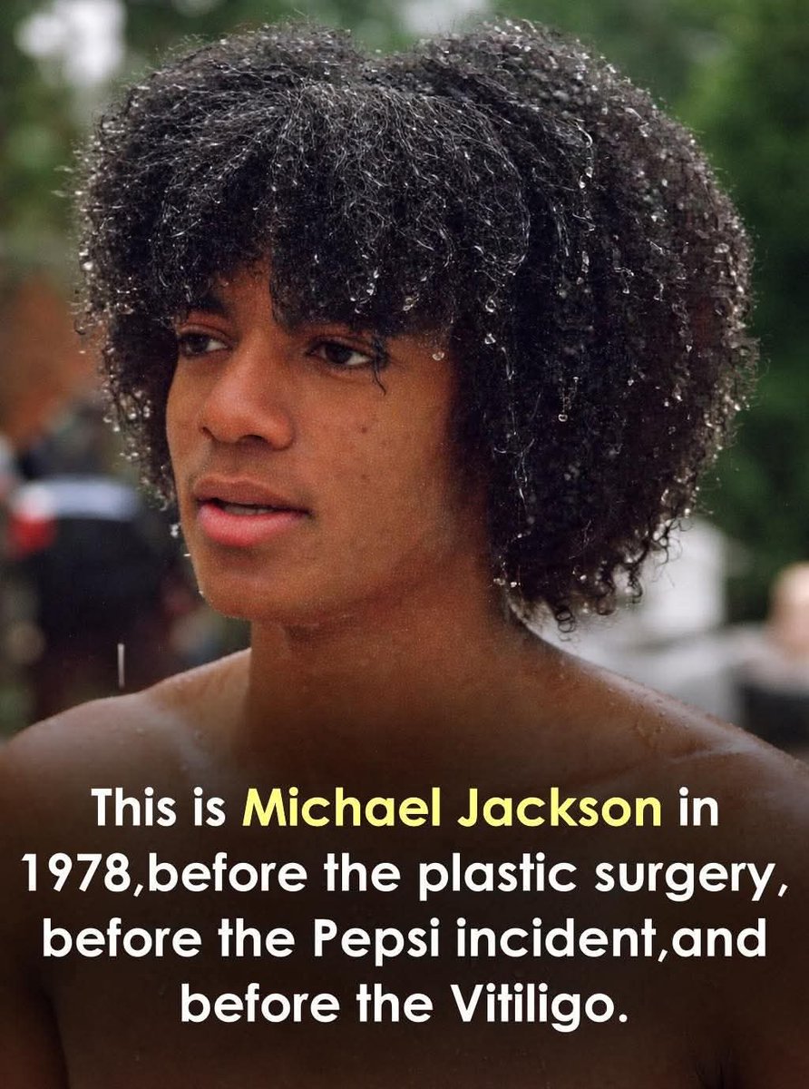 This is Michael Jackson in 1978—before Thriller, before Pepsi, before everything changed.

He was just 20. Off the Wall hadn’t released yet, and the global icon he would become was still ahead.

Born in Gary, Indiana, he had already spent over a decade in the spotlight. But here,