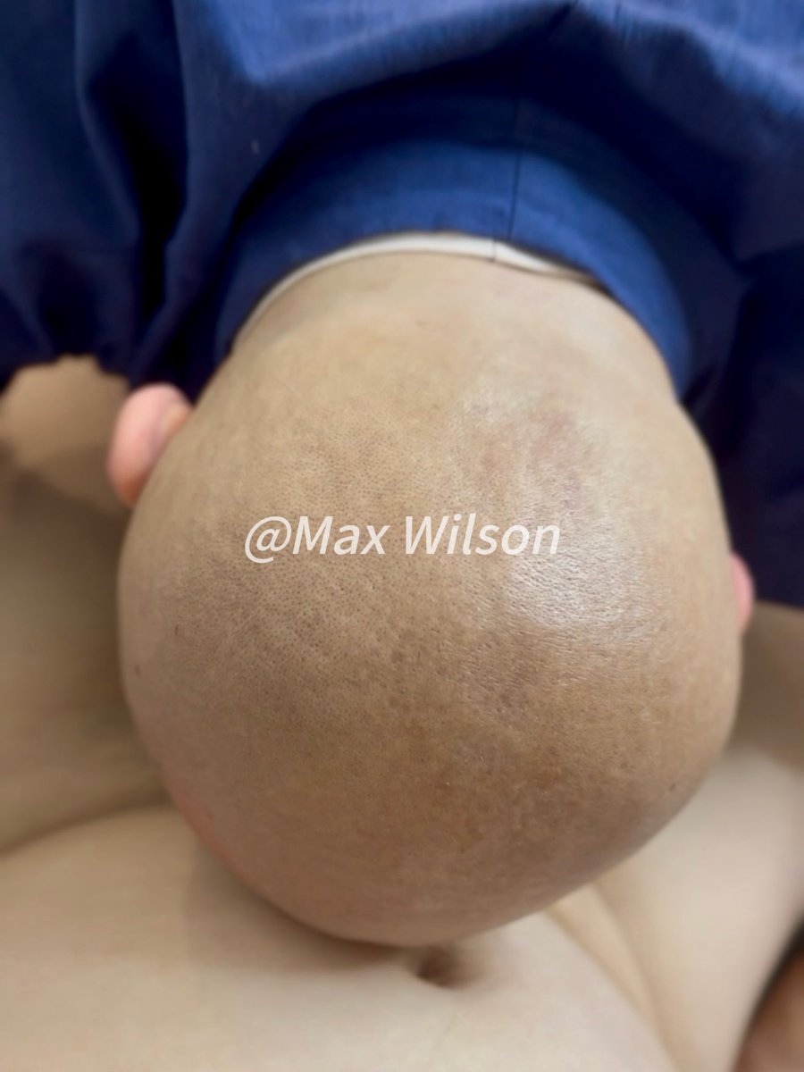 Max tweet media