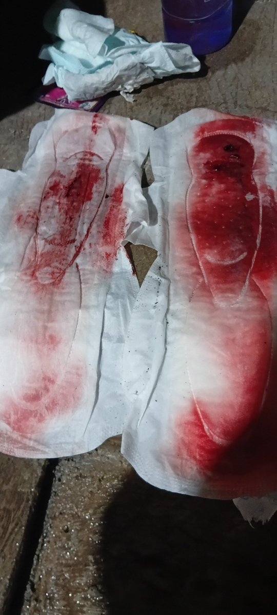 CrewLincak58457's tweet image. Ini mens yg sore punya nya tetangga darahnya masih segar, gumpalan darahnya enak

#mens #cewekmens #pms #pembalut