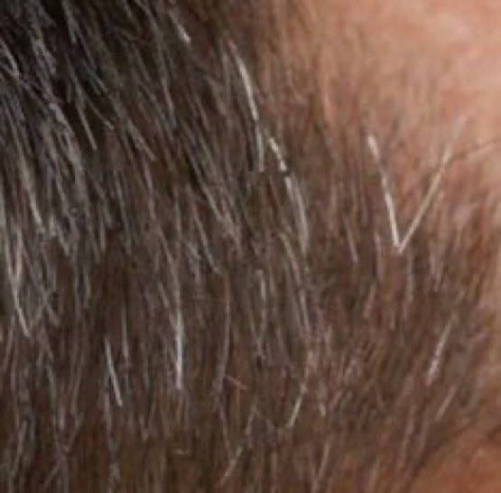 Duele.