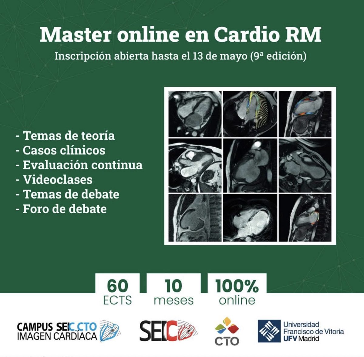 SEIC - Sociedad Española de Imagen Cardíaca tweet media