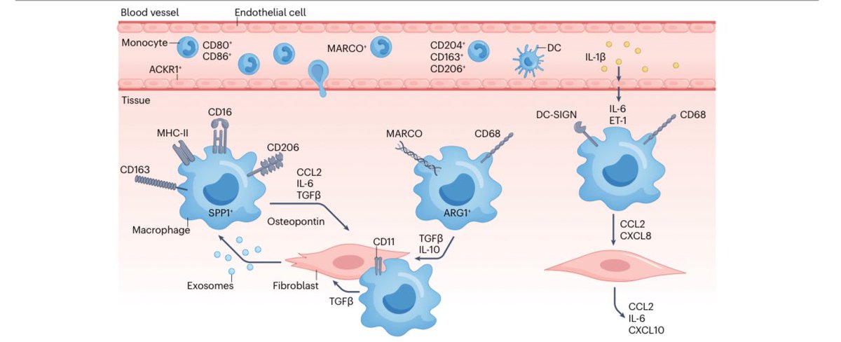 dr_immuno29's tweet photo. 🔥 Fibrosis Unlocked: The Engine of Systemic Sclerosis
📖 Nature Reviews Rheumatology (2026)

🧵 Why fibrosis drives outcomes in SSc — and what really fuels it 👇

1️⃣ Fibrosis = failed healing loop
→ Persistent ECM → organ damage & failure

2️⃣ Core triad ⚠️
🩸 Vascular injury + 🔥 immune activation + 🧬 aberrant repair

3️⃣ Fibroblasts = game changers
→ Not passive!
→ Control ECM, inflammation & angiogenesis

4️⃣ Heterogeneity matters 🎯
→ Multiple fibroblast subsets
→ Disease = shift to profibrotic phenotypes

5️⃣ Immune cross-talk 🔁
→ B cells, T cells, macrophages amplify fibrosis
→ Cytokines + autoantibodies drive activation

6️⃣ Vascular injury = starting point
→ Endothelial apoptosis early
→ Platelets, serotonin, EndMT → fibrosis

7️⃣ Self-sustaining loops ♻️
→ Senescence (SASP)
→ Epigenetic memory
→ Persistent myofibroblasts

8️⃣ Key pathways 🧬
→ JAK–STAT | WNT | Hedgehog
→ Nuclear receptors | Nerve–fibroblast axis

9️⃣ ECM is ACTIVE ⚡
→ Matrikines/matricryptins modulate fibrosis
→ Both pro- & anti-fibrotic roles

🔟 Take-home 🚨
→ Fibrosis is multi-cellular & multi-pathway
→ Target cross-talk = future therapies

📌 DOI: https://t.co/Rp8NwBJCGQ

#SystemicSclerosis #Fibrosis #Rheumatology #MedTwitter #Autoimmunity