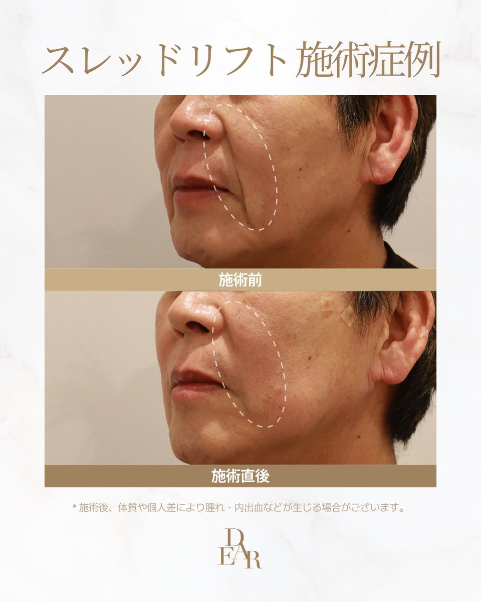 【韓国美容】チョンダムディアクリニック tweet media