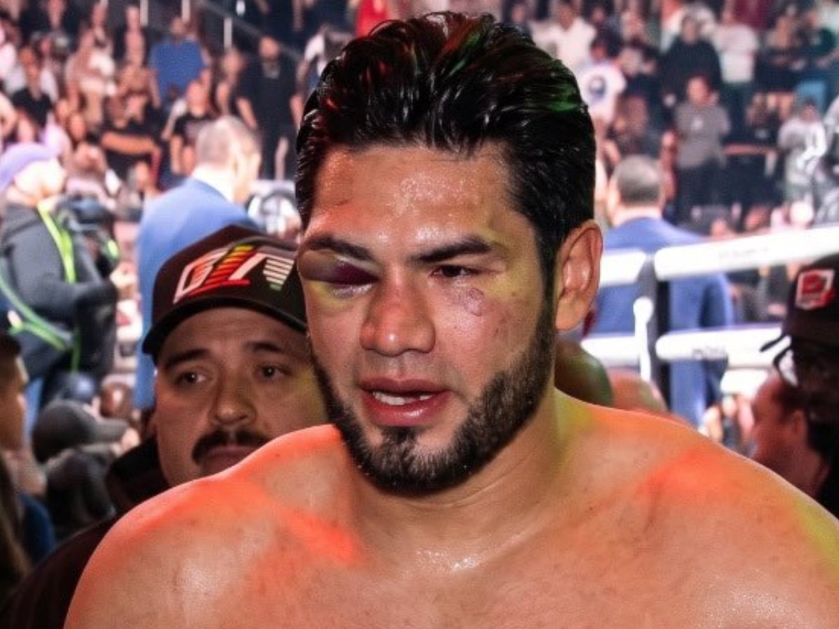FeareddCuck's tweet photo. @itsdafanta Sheesh. Punched his teeth out https://t.co/7GjO2yXKmB