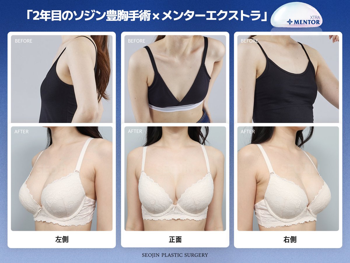 韓国整形No.1ソジン美容整形外科 tweet media