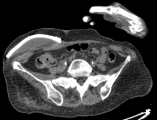 igoraustin's tweet photo. What is the name of this procedure? https://t.co/ysRLCDjQcn