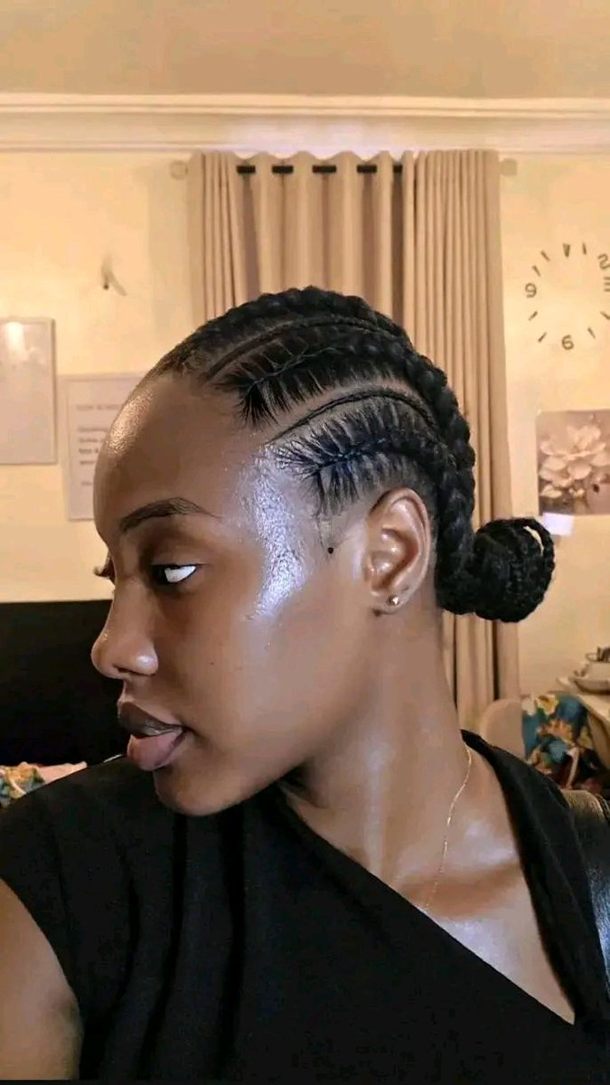 I will choose this over a wig 100m times