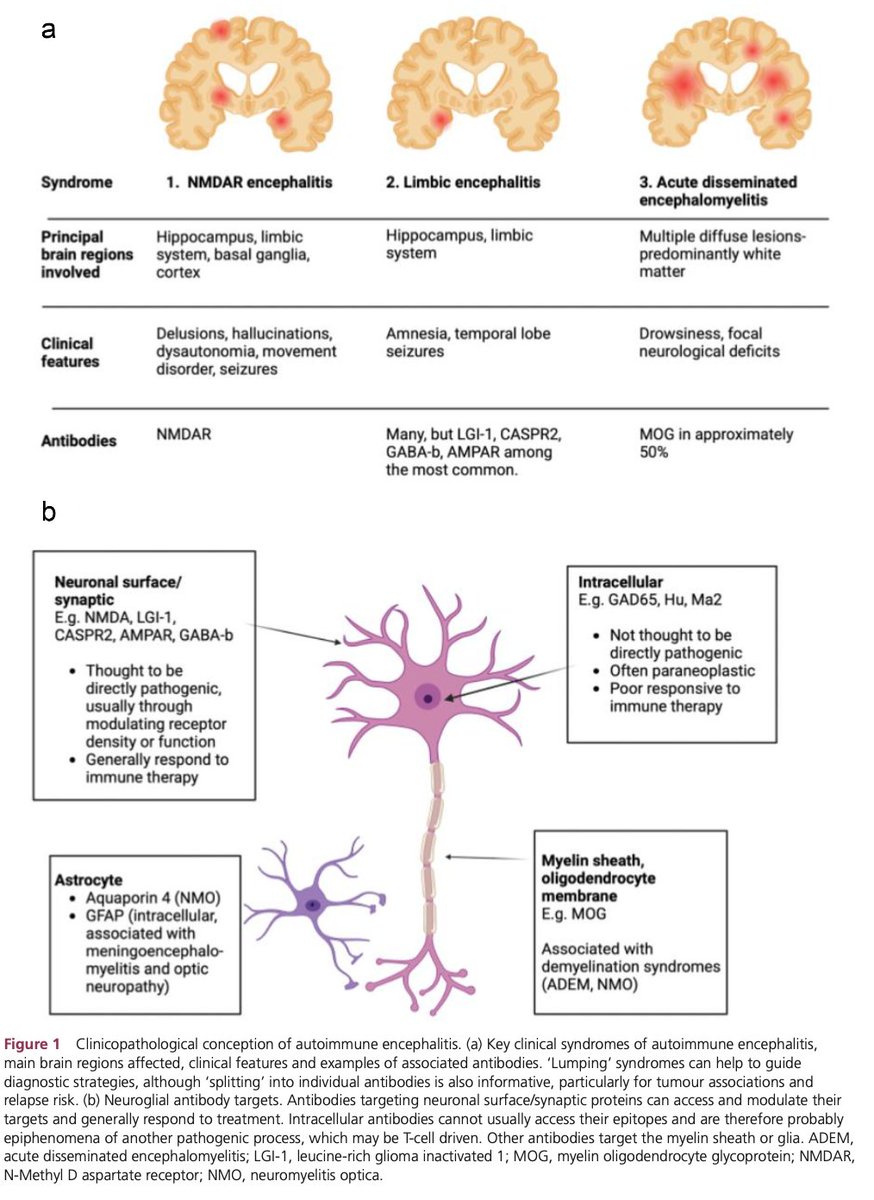 CarlosJMoreno_'s tweet photo. #Review @PracticalNeuro 
Suspected encephalitis in adults.

Pract Neurol 2026;0:1–18. https://t.co/JzZNdYbYPG