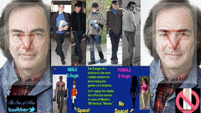 DaveXRPLion31's tweet image. Neil Diamond fails the Forensic Tests/Bio female Skull match/5x the female gait/legs crossed/1 foot behind the other/1 x flamingo foot/but Fanx for playing CSI with me. It's ALL of them.. No Exceptions 🐎 💦.  #MAGA #TRUMP2024