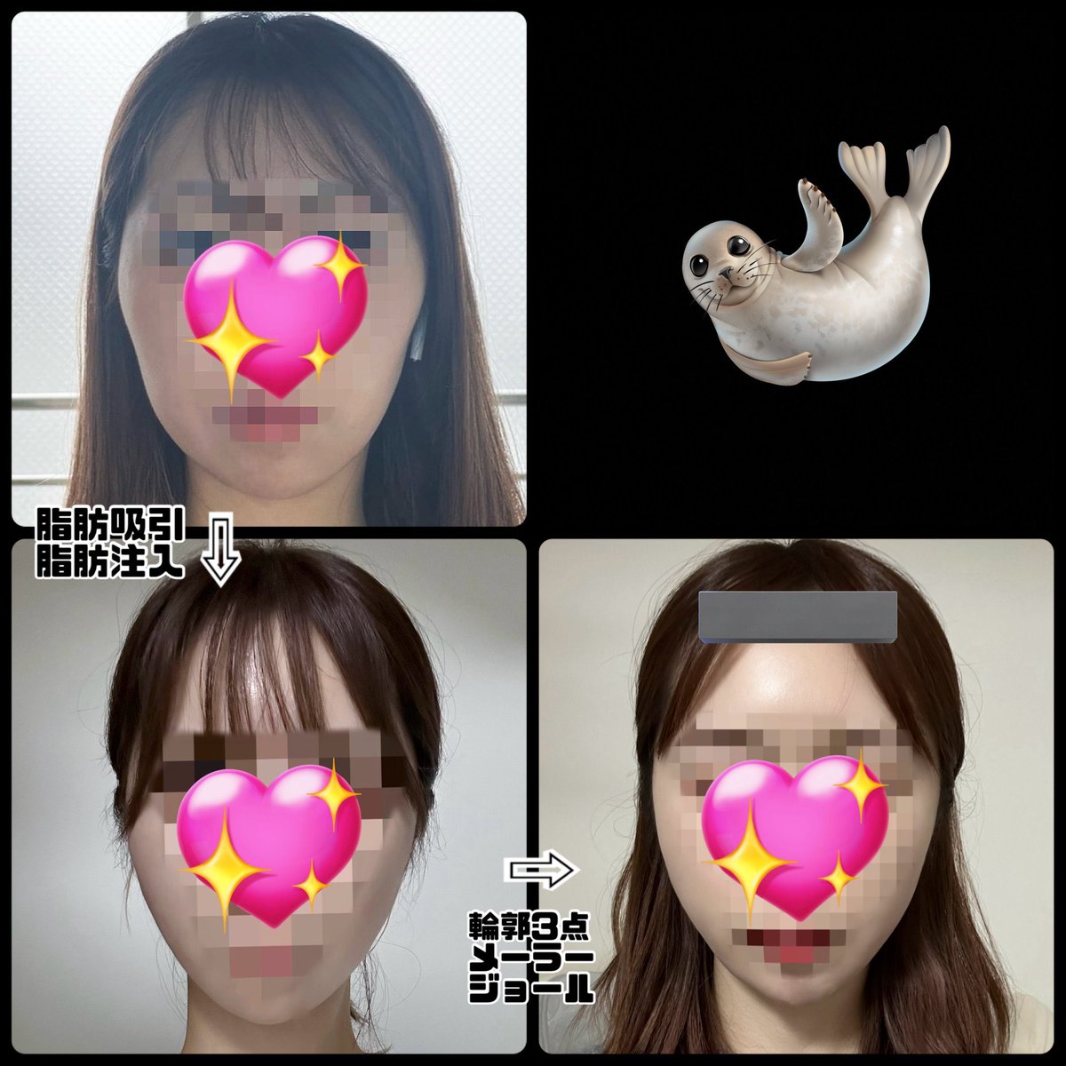 szyoon_2's tweet photo. 私は面長のままだけど輪郭はかなり整った👏 https://t.co/659yyq71TT
