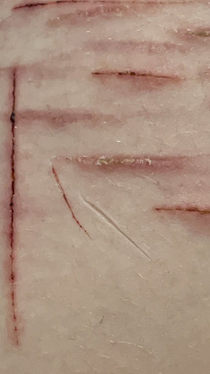 archies_sharkz's tweet photo. yay styros
FAKE SFX MAKEUP
#shtwt #shedtwt https://t.co/cVbweAE4rO