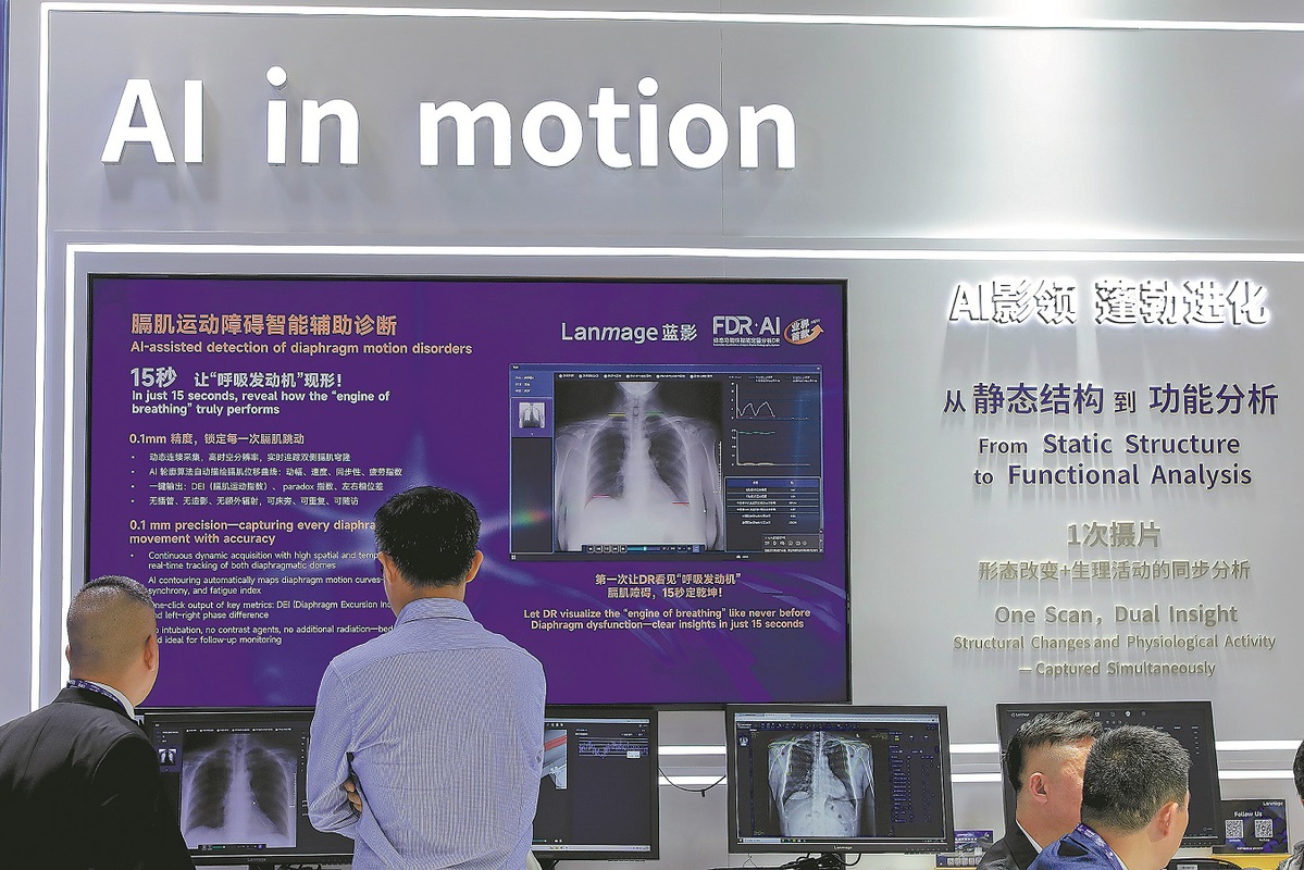 ChinaDaily's tweet image. As artificial intelligence gains traction in China's healthcare system, experts say its expansion is following a clear pattern, shaped as much by clinical realities as by technological capability. #tech #AI bit.ly/4dmkChJ