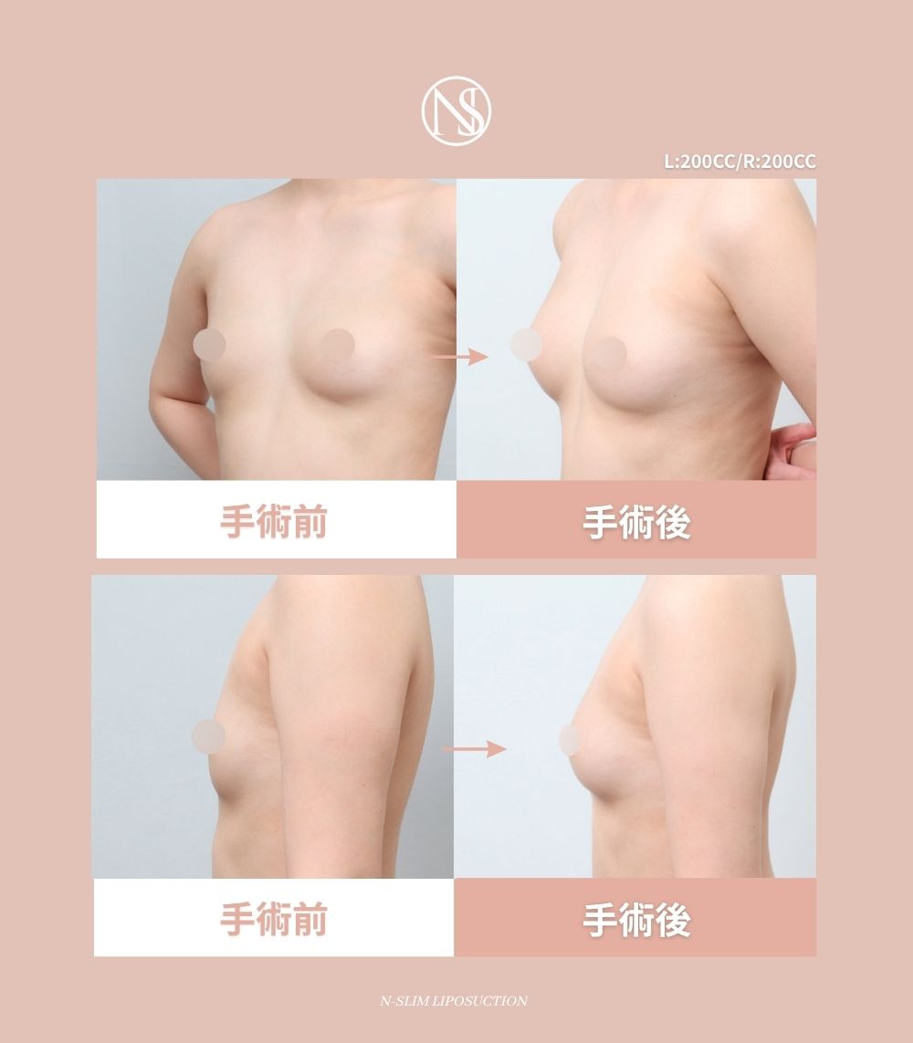 Nスリム医院 / 엔슬림의원 tweet media