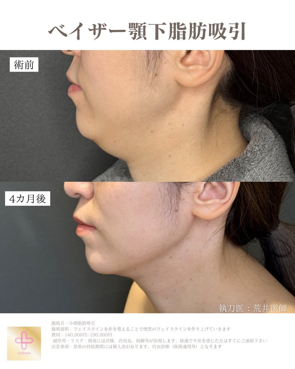 UBクリニック錦糸町院長👩‍⚕️荒井香織@目元整形、クマ取り、ベイザー脂肪吸引の美容外科医 tweet media