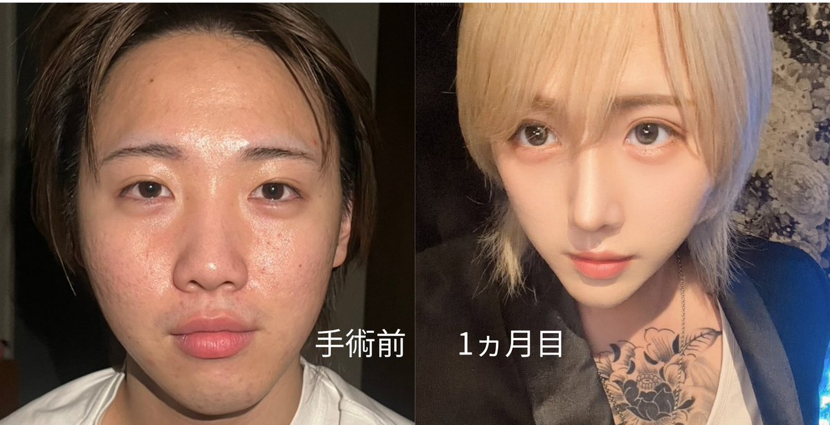 玲 tweet media