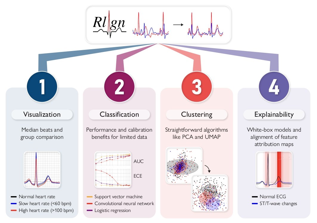 ESC_Journals's tweet image. The Rlign algorithm for enhanced electrocardiogram analysis through Heart-Rate-Corrected ECG alignment for explainable classification and clustering ow.ly/qbNE50YUtaU 

#EHJDigital #MachineLearning
@BruiningNico @rafavidalperez @fwasselbergs  @rbcasado