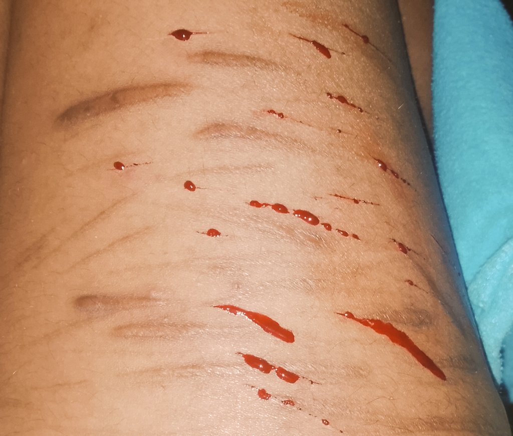 MaturanaSa24596's tweet photo. Chikoz reiniciamos con mini cortes pues hace un tiempo que no me corto y es en las piernas, por ende no se, me toma un día adaptarme ajjajaj 

Pd. Mañana/ más rato si cortes bien chimbitas 

#twt #shtwt #shedtwt #shedtw #shtw #tw #cutspo #scarpo #cutspotwt #scarpotwt https://t.co/52eOMLDEA9