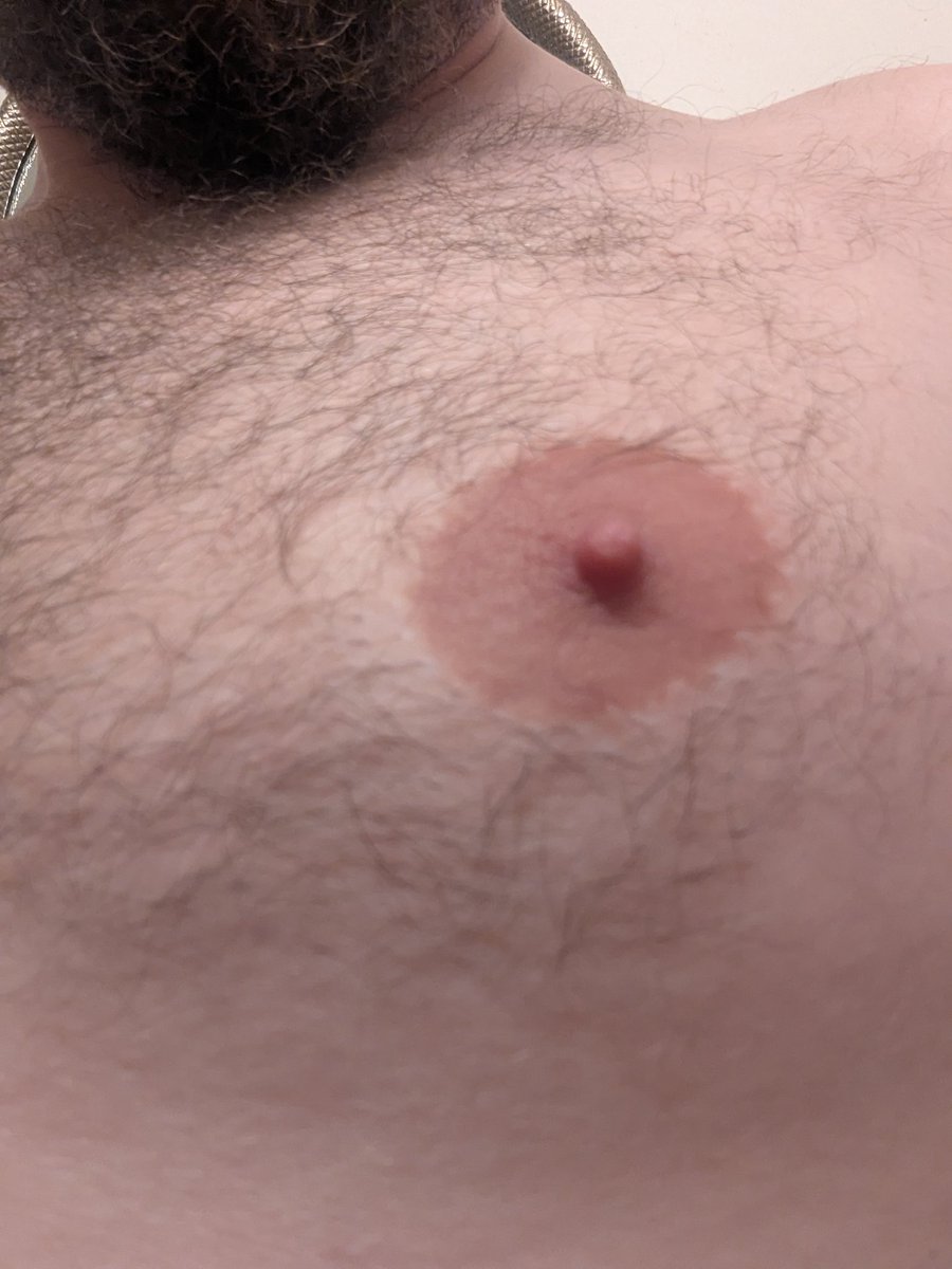 DangersTimothy's tweet image. Men's chests are under-appreciated. I always wondered why I developed this way. Being shamed about my physical features has been a major part of my life. How can I be ashamed of embarrassed if I am able to expose myself like this?            

#nipplesquad #nipplelove #selflove