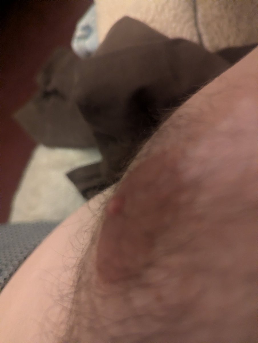 DangersTimothy's tweet image. Men's chests are under-appreciated. I always wondered why I developed this way. Being shamed about my physical features has been a major part of my life. How can I be ashamed of embarrassed if I am able to expose myself like this?            

#nipplesquad #nipplelove #selflove