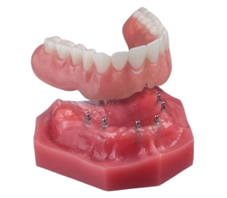 rickmillerdds's tweet image. Bent Tree Dental offers secure, comfortable denture alternatives with mini dental implants. Call our office today &amp;amp; book a FREE consultation! #dallas #dentalimplants #dentist bit.ly/3Xr3CPz