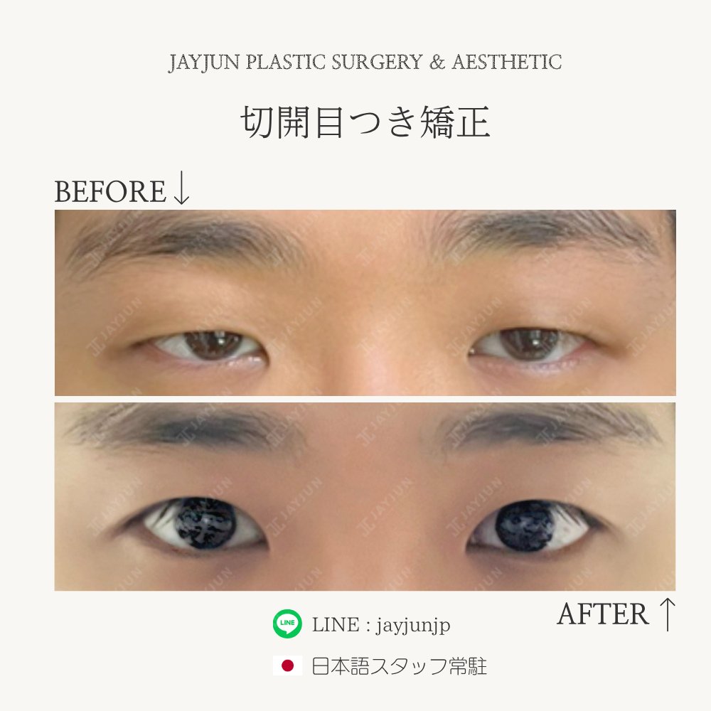 〚公式〛JAYJUN美容外科•皮膚科｜韓国美容 tweet media