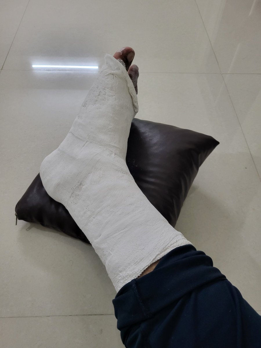 JabhadeTushar's tweet photo. @HeroMotoCorp @jagograhakjago It’s been 20 days since my leg was fractured in a bike stalling incident where the vehicle ran over my leg. I’m still suffering, and there has been no action from your side.

If this isn’t addressed within 24 hours, I will file an FIR. https://t.co/x7iNRSGHmj