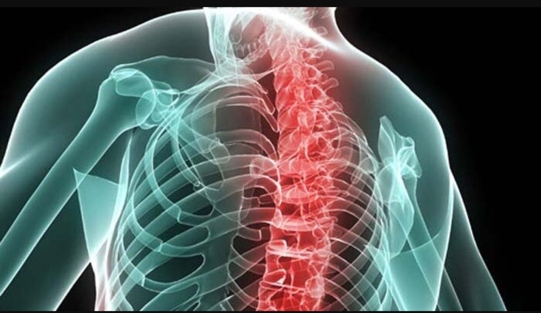 Spondiloartrite Assiale: Mal di Schiena Prolungato con Diagnosi in Ritardo. Colpisce 9.000 Persone Ogni Anno. Le Avvertenze della Società Italiana di Reumatologia (SIR)

agenziaomniapress.com/2026/05/spondi…