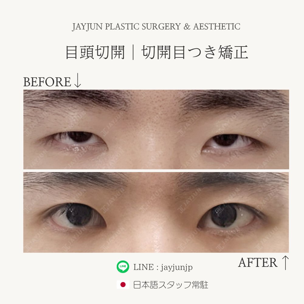 〚公式〛JAYJUN美容外科•皮膚科｜韓国美容 tweet media