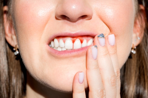 johnhopkins_dds's tweet image. Maintaining good oral hygiene and routine dental care increases your chances of keeping your natural teeth. #gulfport #implant #dentist bit.ly/3wQo7dF