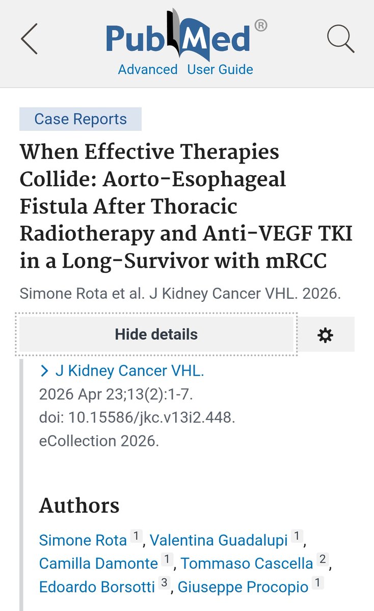 g_procopio_'s tweet photo. Case report: aorto-esophageal fistula after thoracic #Radiotherapy + anti-VEGF TKI in a long-survivor with #mRCC. Highlights the need for awareness of rare but severe toxicities and multidisciplinary care.
More info here: https://t.co/iquGsHlgt9
#Oncology #Genitourinary https://t.co/3z8uP2w2Fq