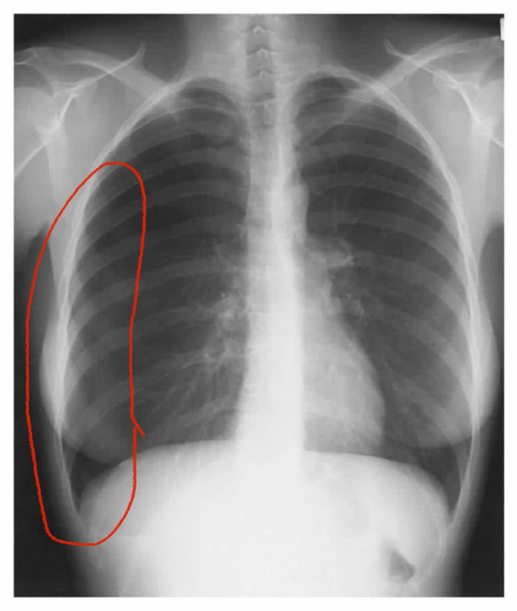 CardiovascularCorner tweet media
