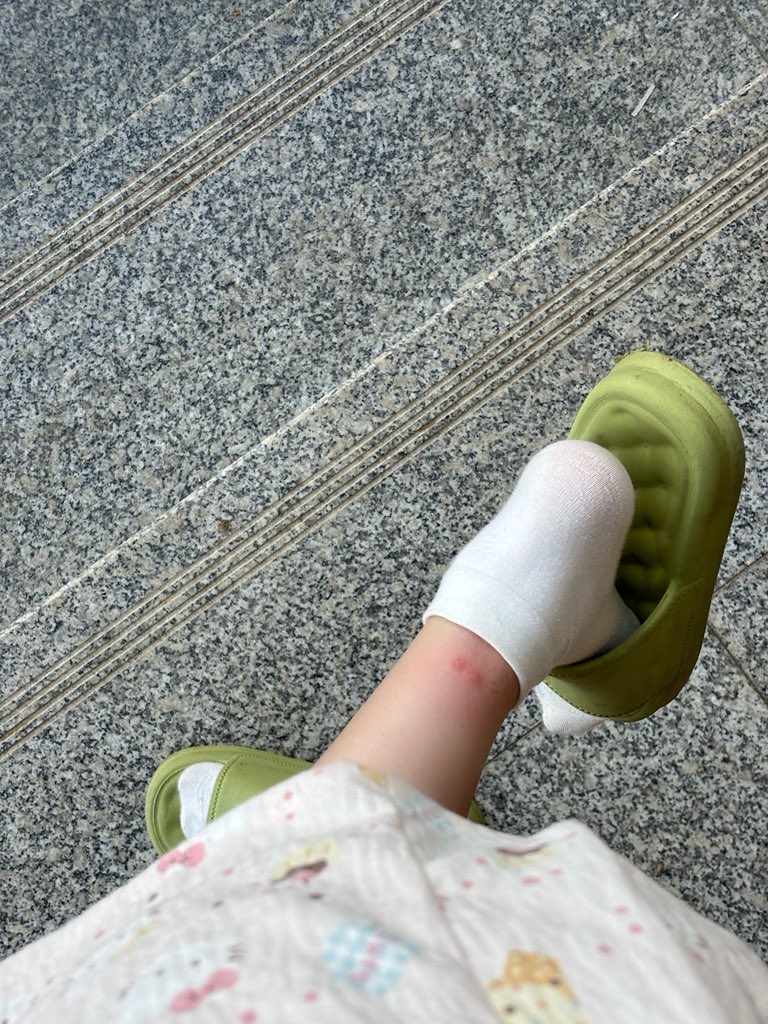 卖萌被肘击 tweet media