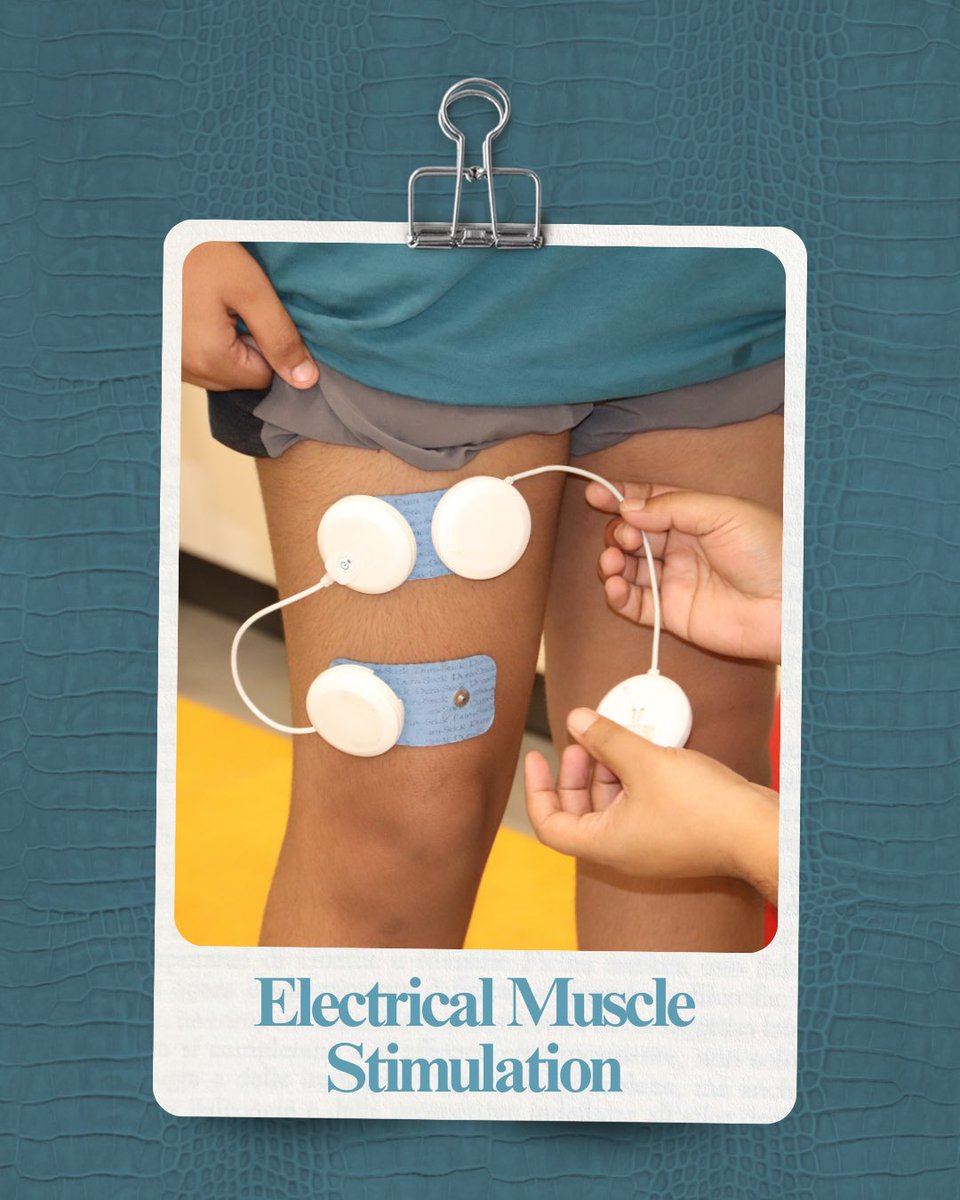 Physioactive_'s tweet image. EMS uses small, controlled electrical impulses to stimulate the muscles and encourage them to contract. These impulses mimic the natural signals your body sends to activate muscles, helping them “wake up” and start working again.

#PhysioActive #PhysioTherapy #Wellness #Therapy