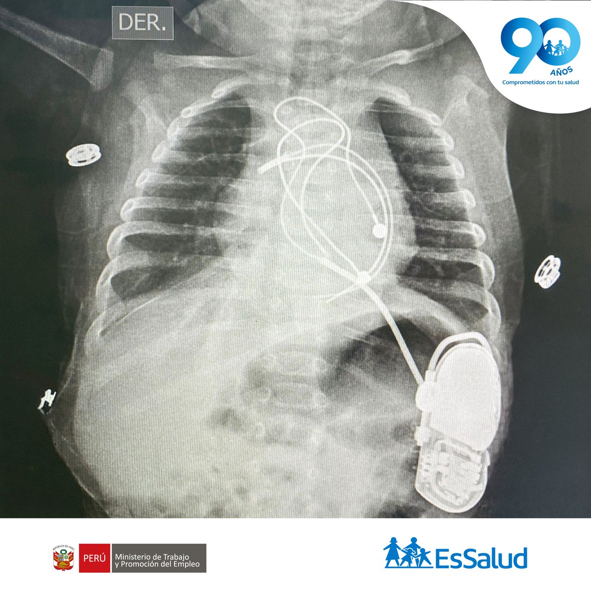 EsSalud Perú tweet media