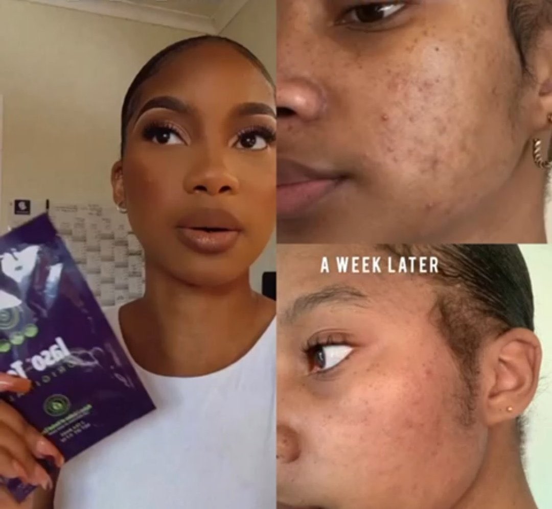 LydiaTHaPoet's tweet photo. R700 for a month package
R1750 for 3 months supply
- clears skin
- relieves constipation
- lose 2-5 kgs in a week
- aids in weight loss
- flattens tummy
📲 +27 65 977 2593
📦 Delivery Avaialble WorldWide
🔗 https://t.co/7gnxX9GdEo
#girltalkza #iasotea #pretoria https://t.co/AtQ10iSet5