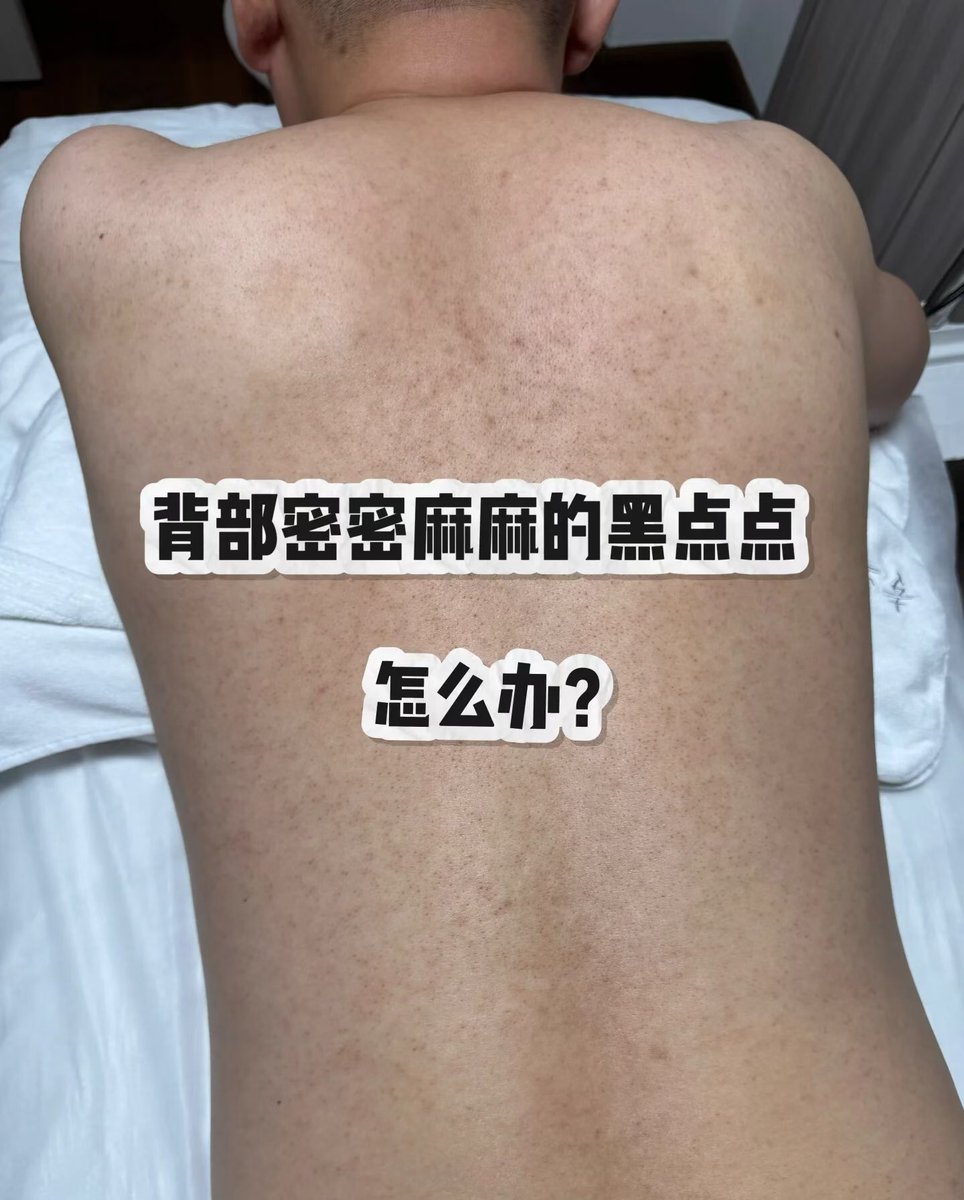 南宁筋肉脱毛师 tweet media