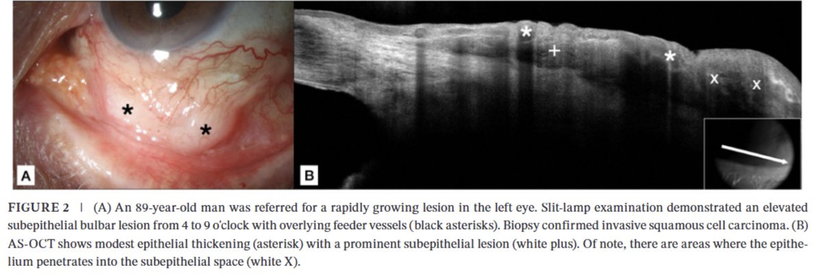Clinical and Experimental Ophthalmology tweet media