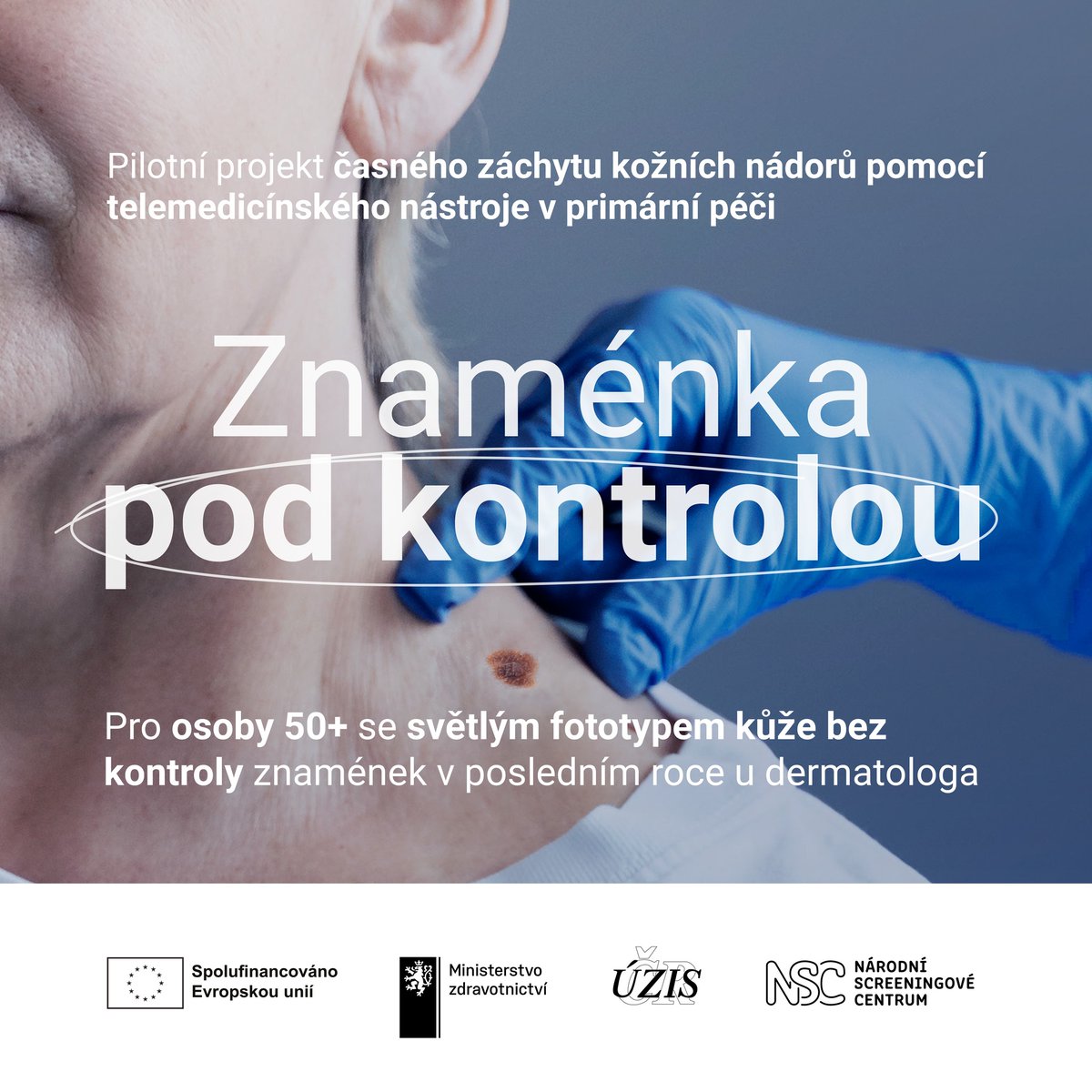 ZdravkoOnline's tweet photo. Je vám 50+ a nebyli jste ještě na kontrole znamének? Možná je právě teď ten správný čas to změnit. 

Kožní nádory patří mezi nejčastější nádorová onemocnění a jejich výskyt roste. Zpočátku nemusí bolet ani na sebe upozorňovat. O to nebezpečnější mohou být. https://t.co/mCEwWOMQ2A

Národní screeningové centrum realizuje pilotní projekt propojující praktické lékaře, dermatology, telemedicínu a umělou inteligenci. Projekt nyní vstupuje do fáze, kdy se do něj mohou zapojit i pacienti.

Projekt je určen pro:
⏺️ osoby 50+
⏺️ se světlým fototypem kůže
⏺️ bez kontroly znamének v posledním roce u dermatologa

Jednoduché vyšetření může odhalit problém včas. 
Nečekejte, až se znaménko změní ve skutečný problém. 🙏