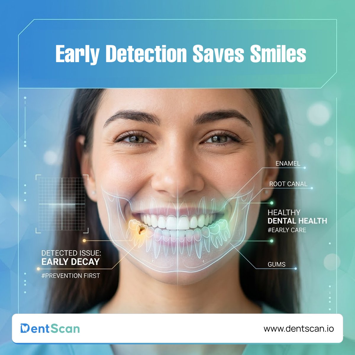 scan_dent's tweet photo. Small issues become big problems if missed.

AI helps detect early—so treatment is faster and outcomes are better.

DentScan makes prevention smarter.

https://t.co/nqc8Qz0qs2

#DentScan #EarlyDetection #AIinDentistry https://t.co/nsX9pXVO5x