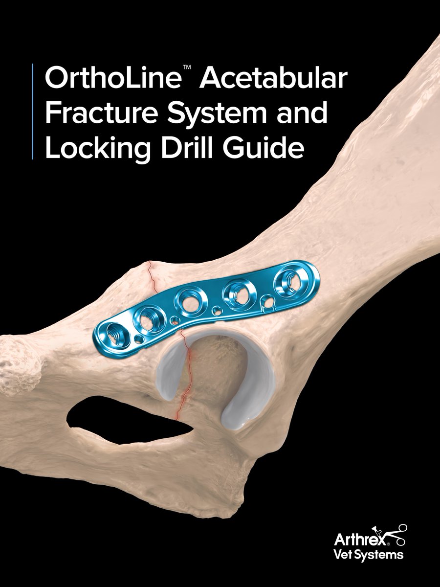 ArthrexVet's tweet photo. Introducing the new Arthrex Vet Systems OrthoLine™ acetabular plates—a precontoured, anatomic locking plate system designed to address the three major acetabular fracture types: cranial, central, and caudal.

Key features include:

✔️ Anatomically precontoured plates that help reduce operative time

✔️ Divergent screw trajectories that maximize bone purchase and minimize pullout

✔️ Dedicated suture holes that support soft-tissue management and closure, including prosthetic capsulorrhaphy, iliofemoral repair, and capsular closure

✔️ Hooded screw holes that increase thread engagement and reduce soft-tissue irritation

✔️ Extended locking drill guide for hard-to-reach

Learn more about OrthoLine acetabular plates: https://t.co/HP7KeCkgqV