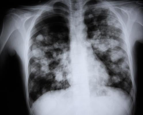 SARS‑CoV‑2 (COVID-19) tweet media
