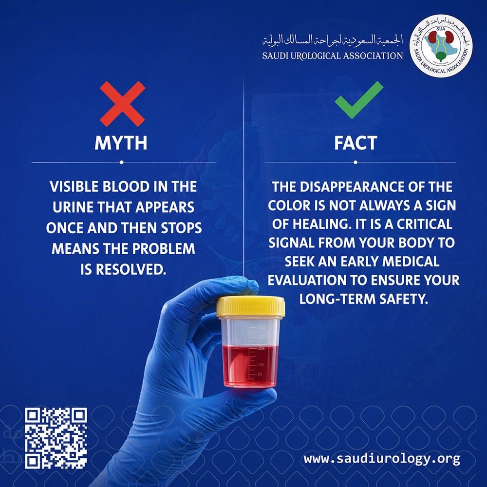saudiurological's tweet photo. Your body is speaking... listen with care. 🌱
Blood in the urine is a signal that deserves attention, even if it clears up quickly and without pain. A specialist consultation ensures peace of mind and provides clarity.
🔗 https://t.co/tfFdYnhuT7
#SUA #HealthAwareness #Urology https://t.co/IvtIAtUotq
