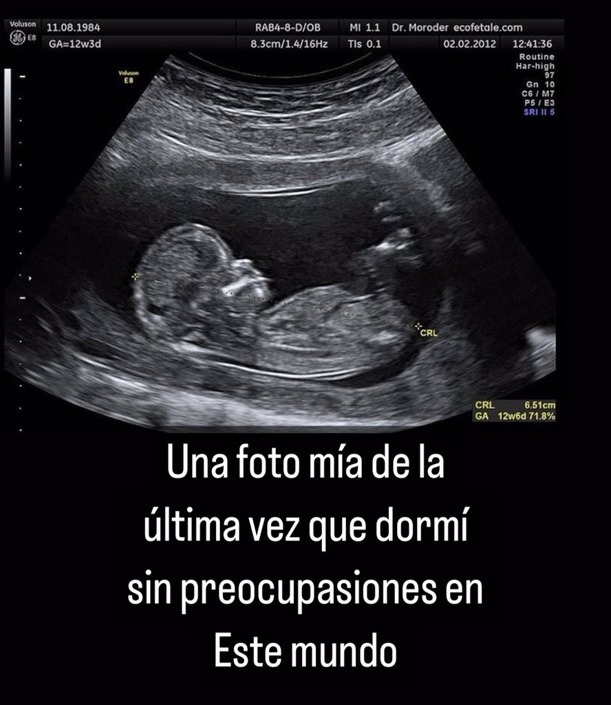 En Júpiter tweet media