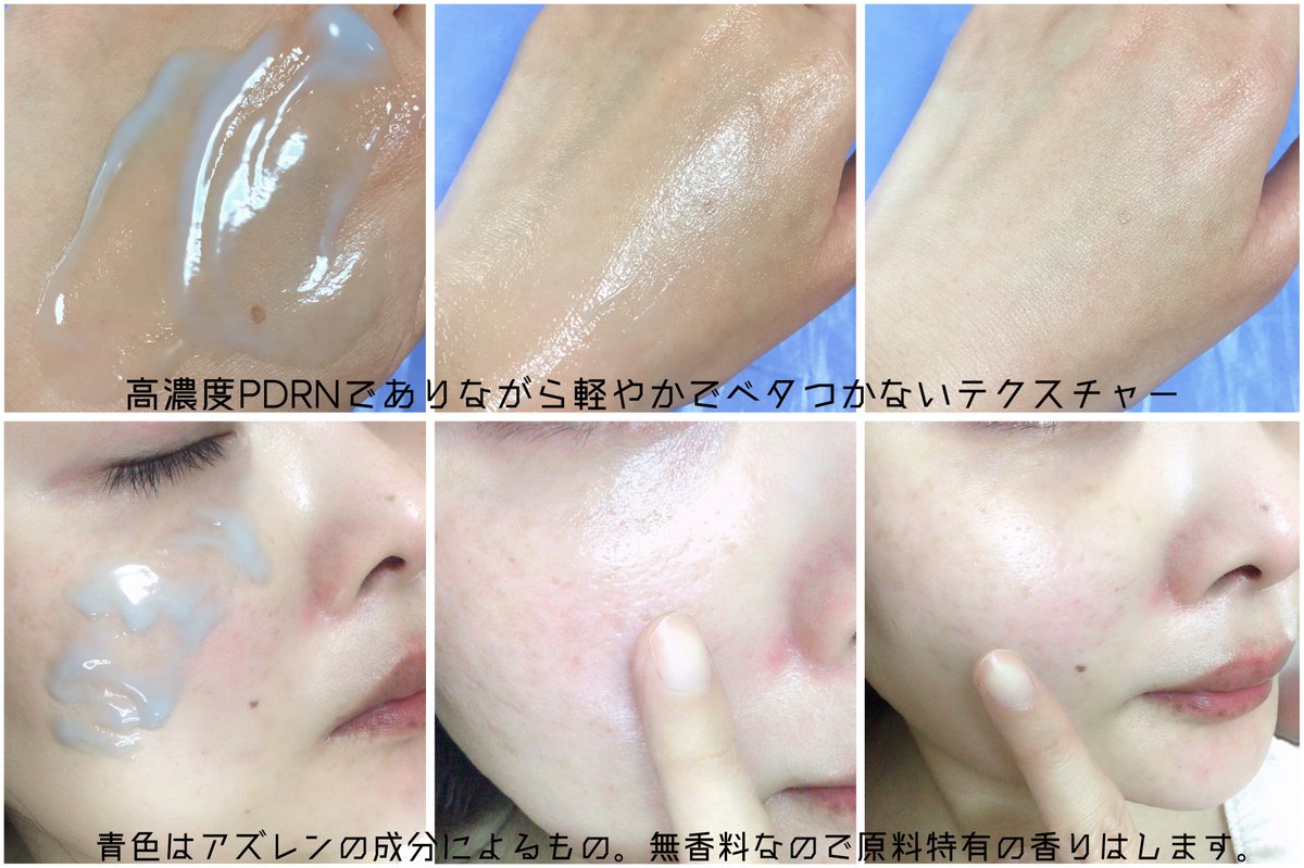 7ayanerune3's tweet photo. PR @pcalm_japan
P.CALM薬局専売新ライン
「Daily Rx 3 Pharmacy Line」が登場🥼🧪
#PDRN クリーム等のセットが韓国のReady Young薬局なら免税でオリヤンよりお得に買えちゃうんです!渡韓予定のある方は必見✈️🇰🇷
日本からはQoo10で単品購入できるのでチェックしてみてね🛒
#PCALM #ピーカム https://t.co/5guj1uwnWu
