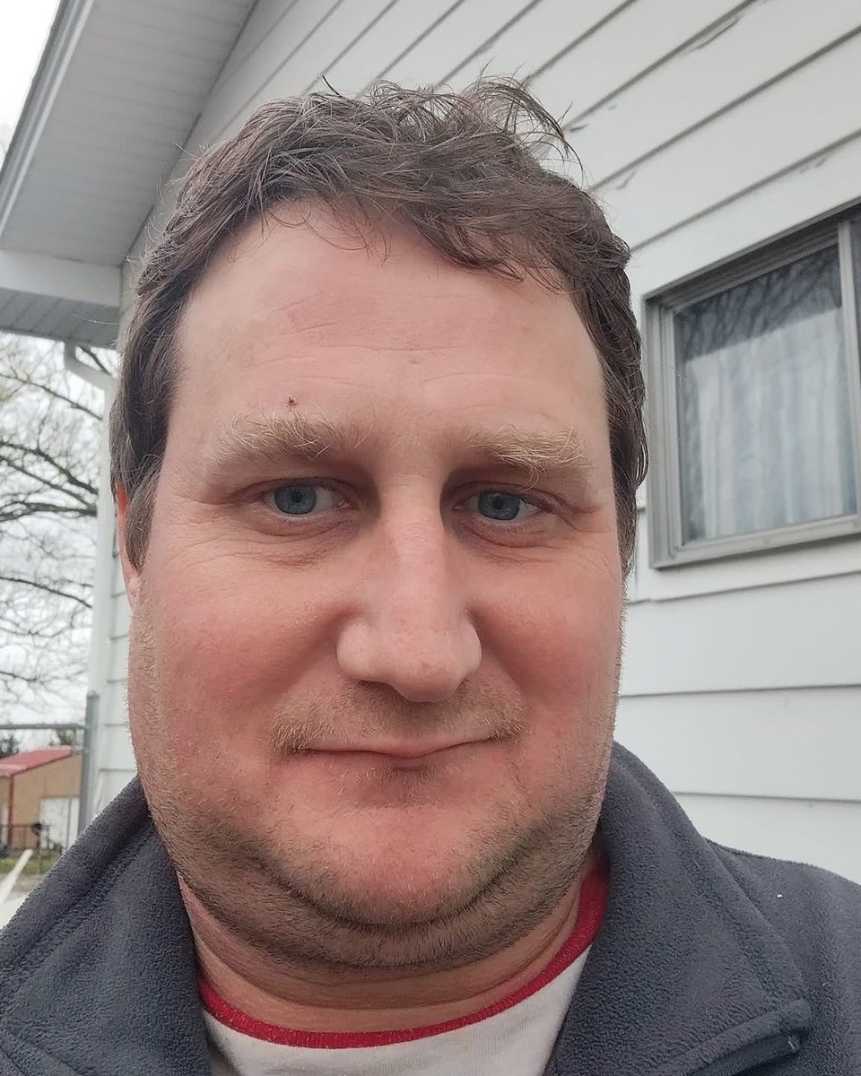 FMDartery's tweet image. "I am a 39-year-old male recently diagnosed with #FMD Following a vascular ultrasound that revealed over 60% narrowing in a renal artery, a renal angiography in April confirmed the diagnosis. I subsequently underwent a balloon angioplasty”
#MenWithFMD