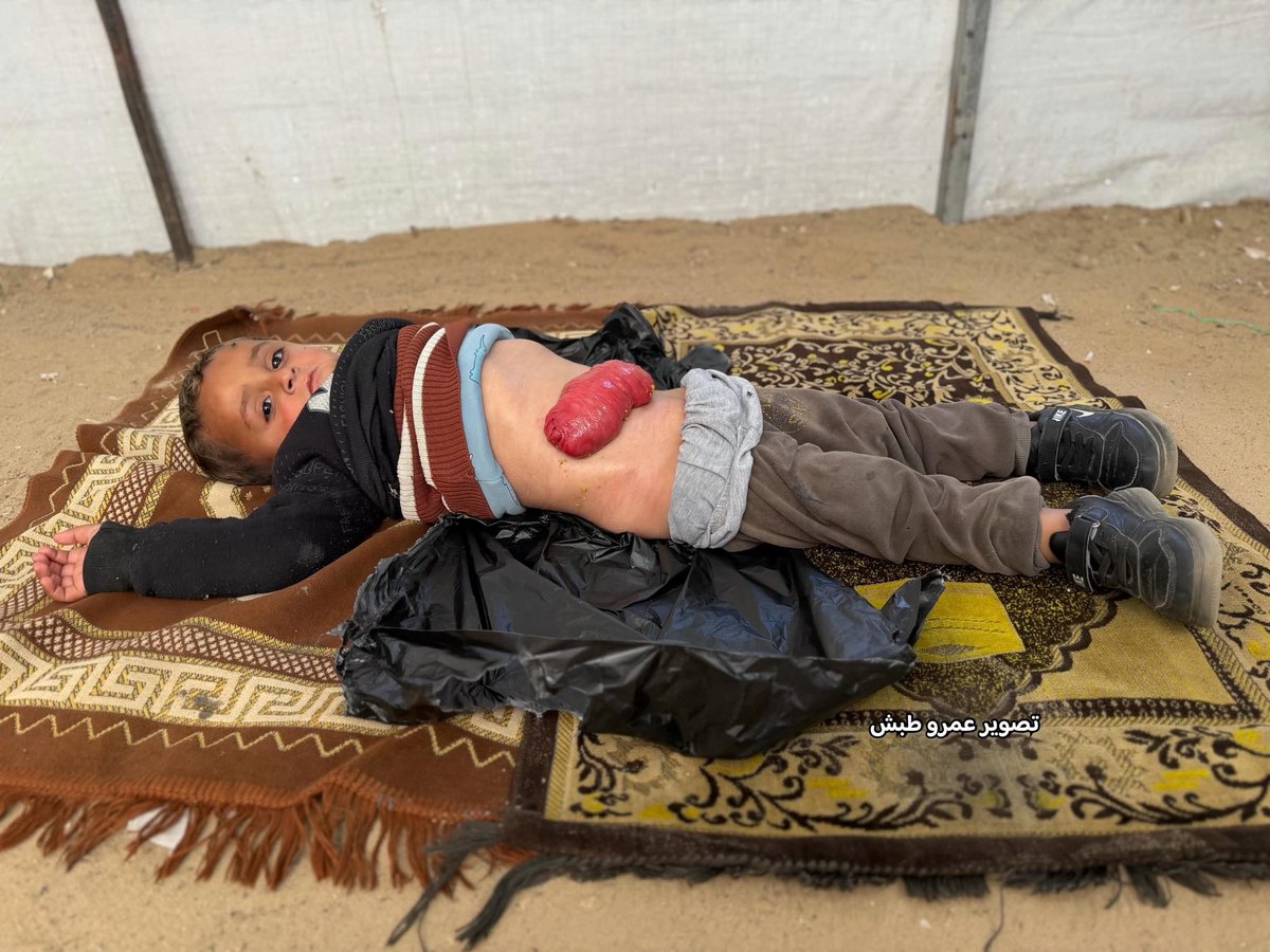 ثائر البنا، غزة 🇵🇸 tweet media